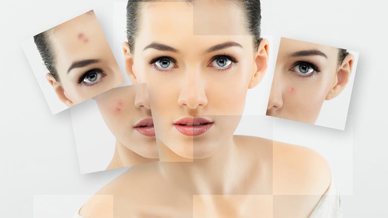 Kosmetyki do pielęgnacji twarzy skóry mieszanej i tłustej 